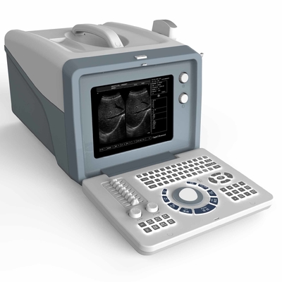 FSC 3D 4D MSK 휴대용 초음파 기계는 트랜스 비잔들을 스캐닝합니다