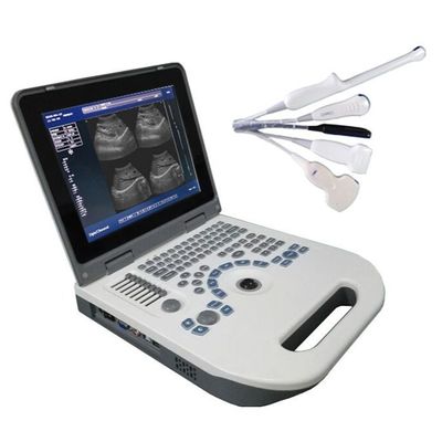 품질  TGC Control Notebook Ultrasound Scanner For Pregnancy Home Use 공장