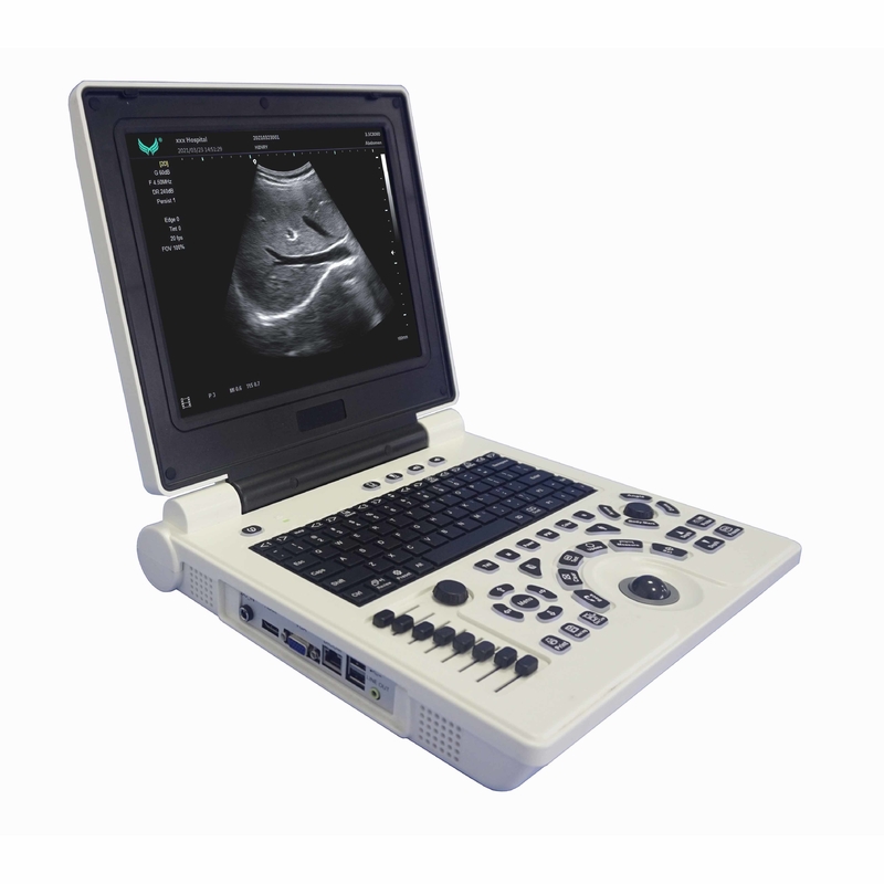 임신에서 OB GYN 휴대용 컬러 도플러 초음파 기계