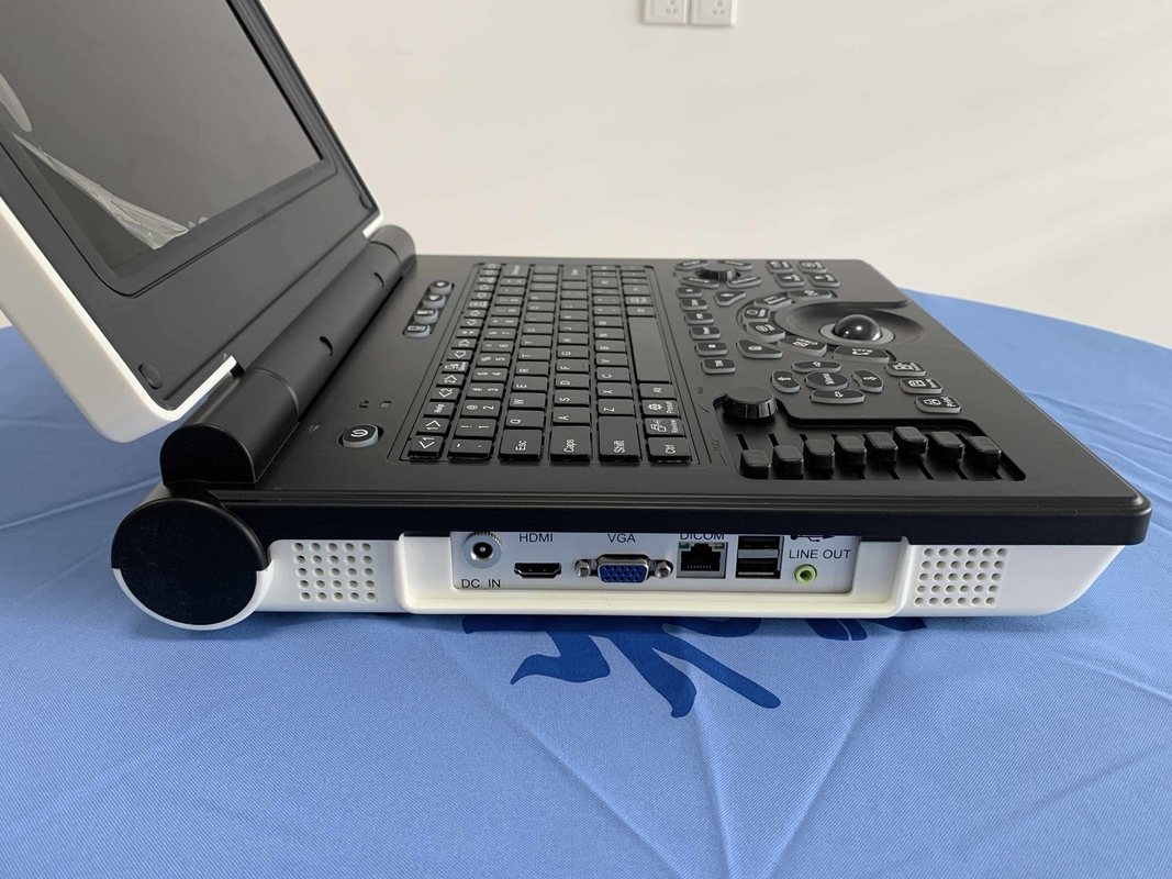 Win7 시스템 가지고 다닐 수 있는 컬러 도플러 초음파 스캐너 3200mAh 배터리