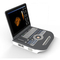 Eco 의학 4D 컬러 휴대용 초음파 진단기 기계 초음파 디지털