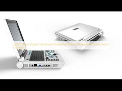 정확한 스캔을 위한 SVGA 비디오 출력 초음파 스캔 시스템 및 2개의 USB 포트
