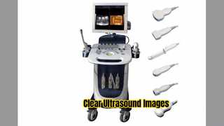 도플러 초음파 스캐너 PW CFM PDI 모드