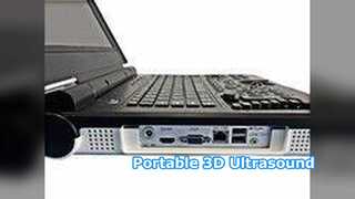 휴대용 초음파 E20 임상병원
