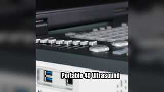 휴대용 4D 도플러 초음파 기계 ICU 준비