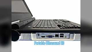 휴대용 컬러 도플러 초음파 E0 비뇨기과 스캔